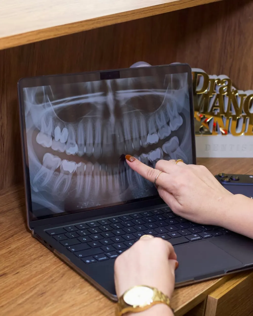 Radiografia panorâmica sendo analisada em um notebook